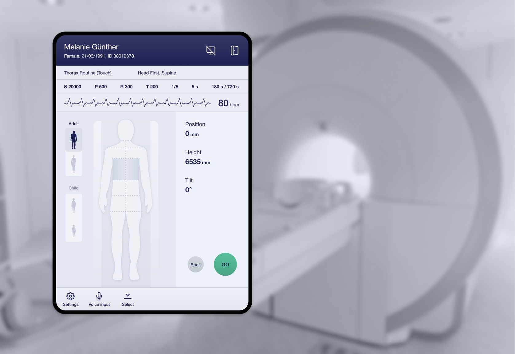 CT scanning